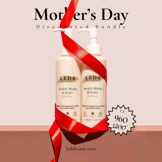 2x Stretch Marks Lotion