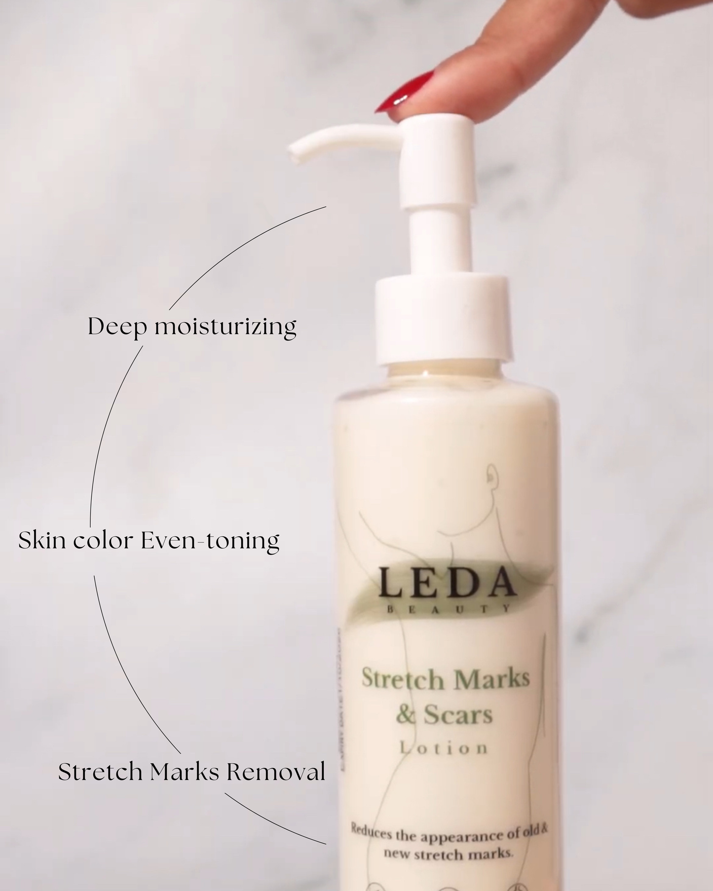 Stretch marks lotion